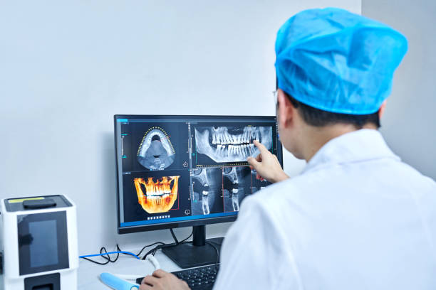 Best Emergency Tooth Extraction in Beverly Hills, CA